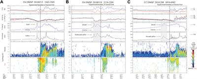 A statistical analysis and comparison of the fine structures of the ion upflow associated with the double-peak subauroral ion drift